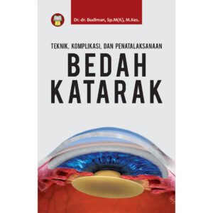 Teknik, Komplikasi, dan Penatalaksanaan Bedah Katarak